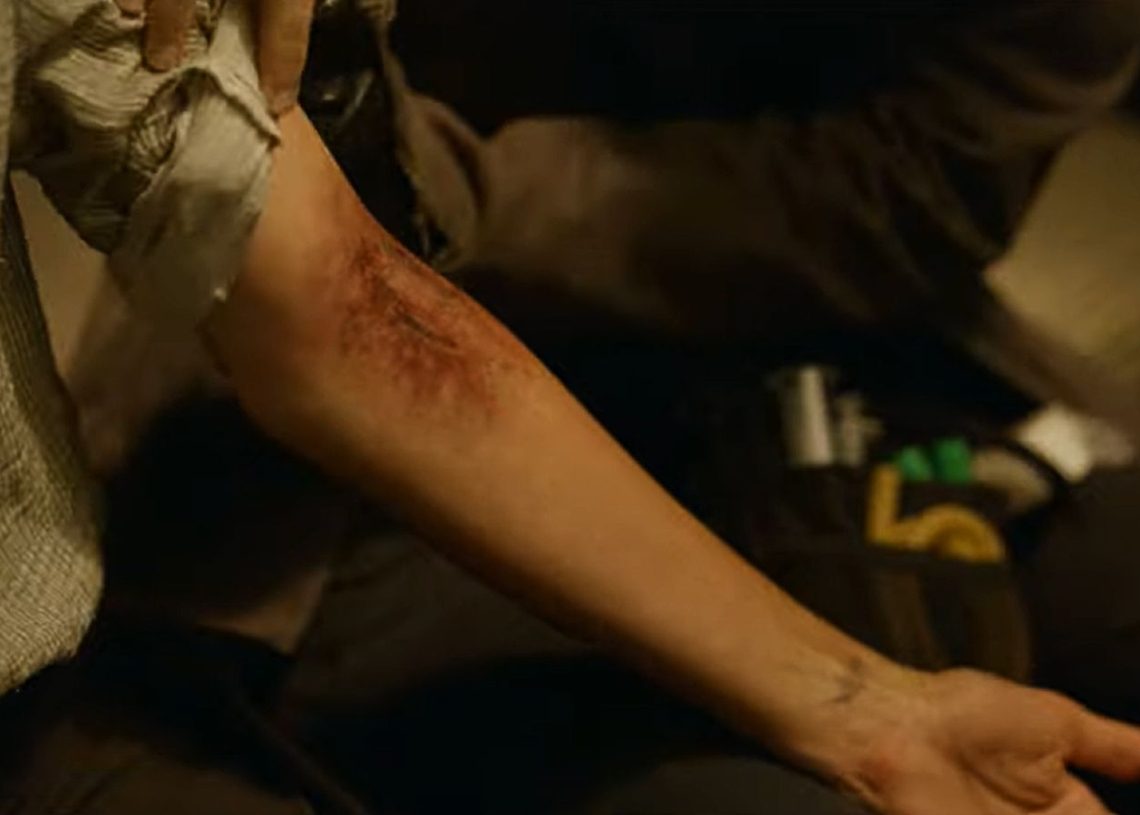 Fear the Walking Dead temporada 8 Madison Clark com marca de mordida de zumbi em seu braço